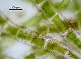 1 – Talli epifiti su Chaetomorpha ligustica (Kützing) Kützing